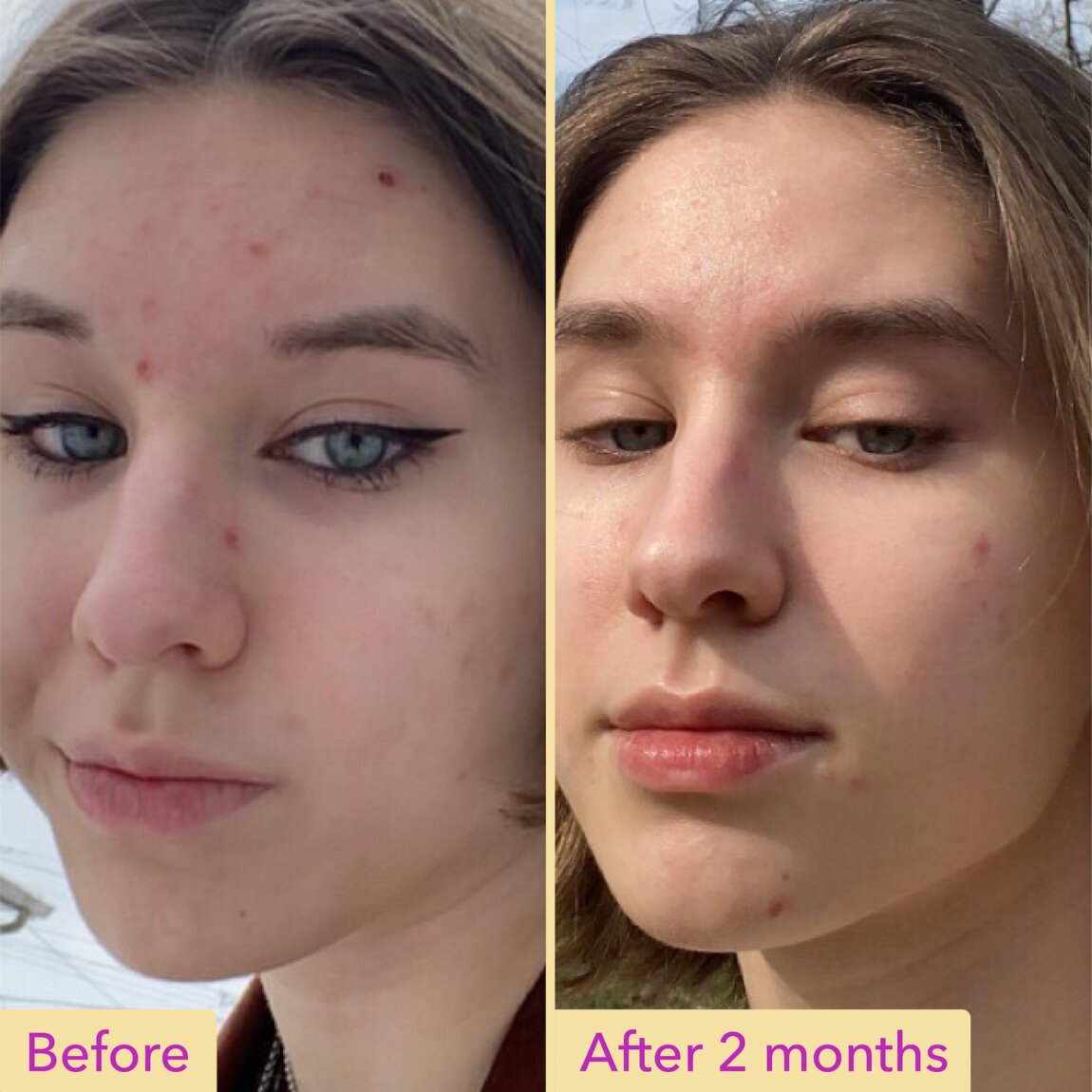 niacinamide-serum-x2 zb_p.jpg