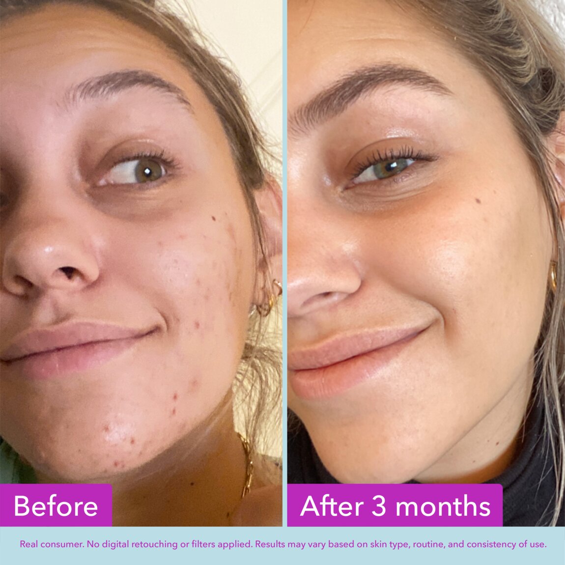 niacinamide-brightening-toner-d2 zb_p.jpg